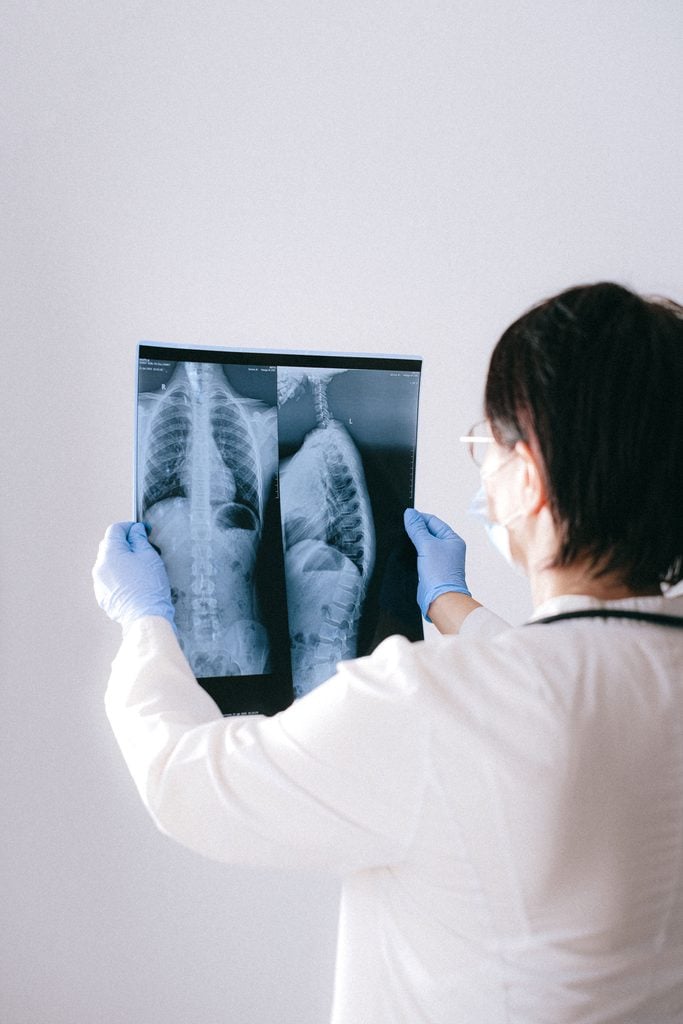 A person in medical attire holds two lung X-rays, examining them against a light background.