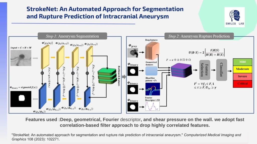 StrokeNet: An Automated Approach for Segmentation and Rupture Prediction of Intracranial Aneurysm. Step 1, aneurysm segmentation from scan imagery; Step 2, aneurysm rupture prediction combining deep features, geometrical features, blood flow pattern, and Fourier descriptor through weighting, feature selection, and classification into mild, moderate, severe, and critical risk categories. Citation: StrokeNet: An automated approach for segmentation and rupture risk prediction of intracranial aneurysm, Computerized Medical Imaging and Graphics 108 (2023): 102271.
